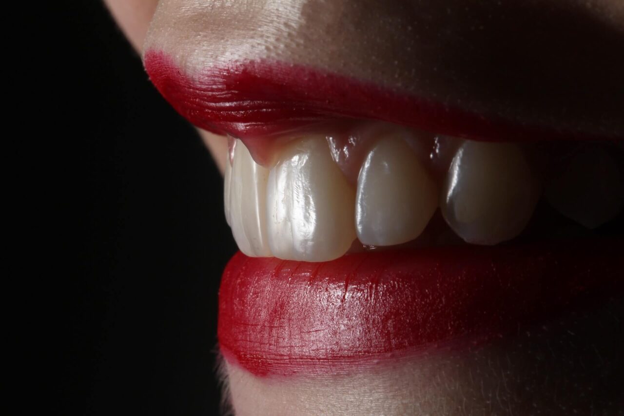 Teeth Cleaning Vs. Teeth Whitening Know the Difference?