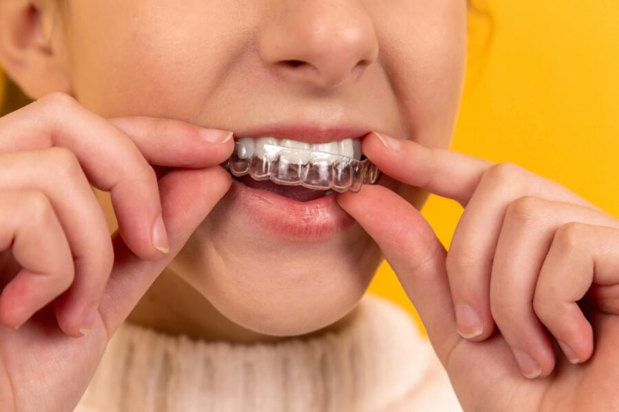 Reasons to Consider Invisible Braces Reasons to Consider Invisible Braces