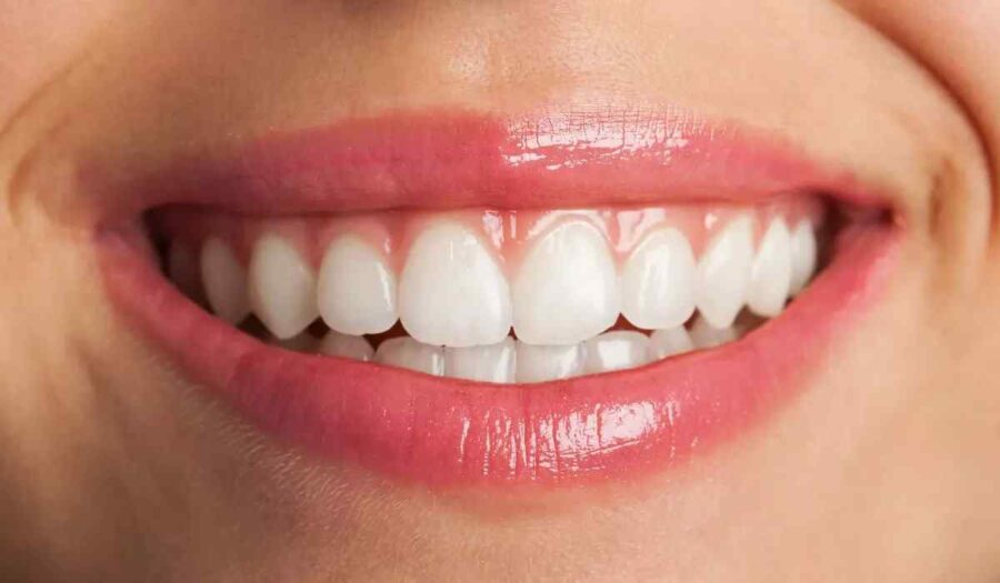 How to Choose the Right Dentist for Teeth Whitening Procedure