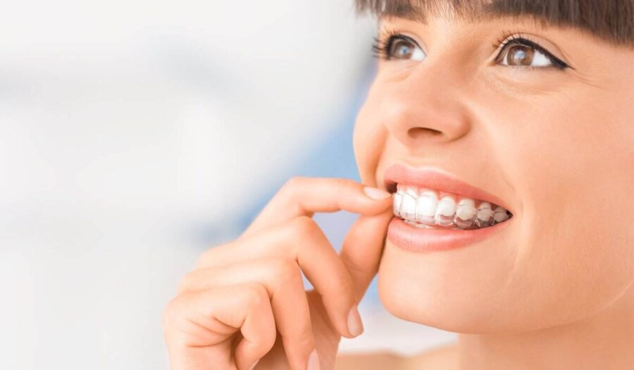 Invisible Braces- How To Know If You Need Them