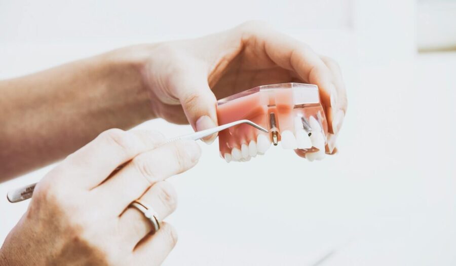 The Ultimate Guide to Replacing Missing Teeth with Dental Implants