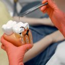 Know the Importance of Preparing for Wisdom Teeth Removal