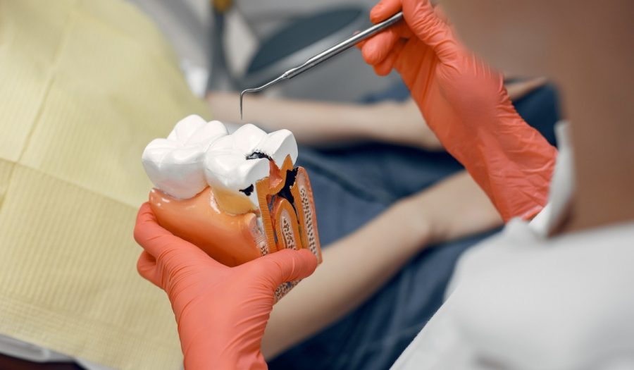 The Importance of Preparing for Wisdom Teeth Removal