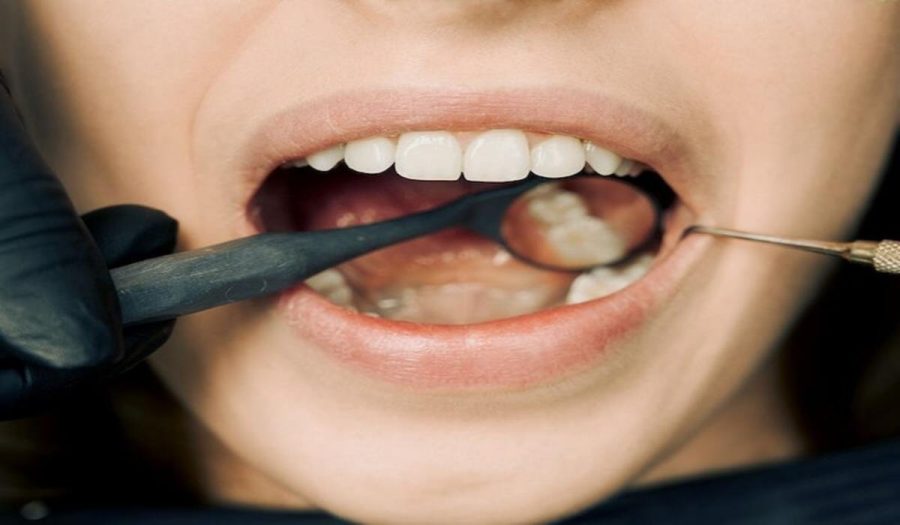 Anaesthesia Options for Wisdom Teeth Removal to Know Anaesthesia Options for Wisdom Teeth Removal to Know
