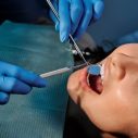 7 Ways Dental Implants Restore Oral Health
