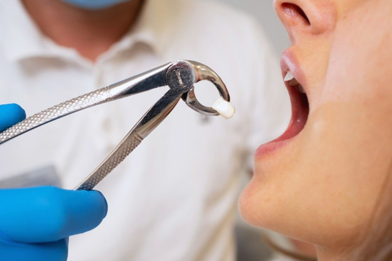 Wisdom Teeth Removal: Is It Necessary for Everyone? Here’s What You Should Know Wisdom Teeth Removal: Is It Necessary for Everyone? Here’s What You Should Know