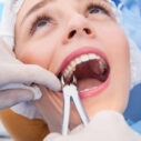 Orthodontic Countdown: Why Braces Plans Often Include Wisdom-Tooth Removal at 15–17