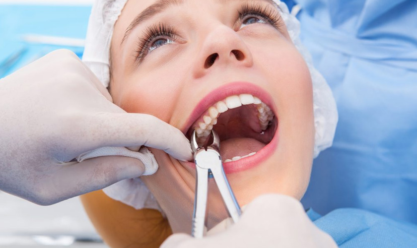 Orthodontic Countdown: Why Braces Plans Often Include Wisdom-Tooth Removal at 15–17