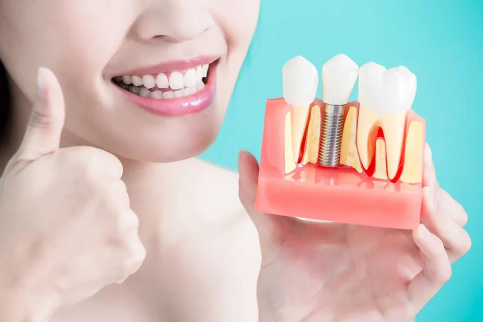 Dental implant model held in hand demonstrating tooth replacement solution.