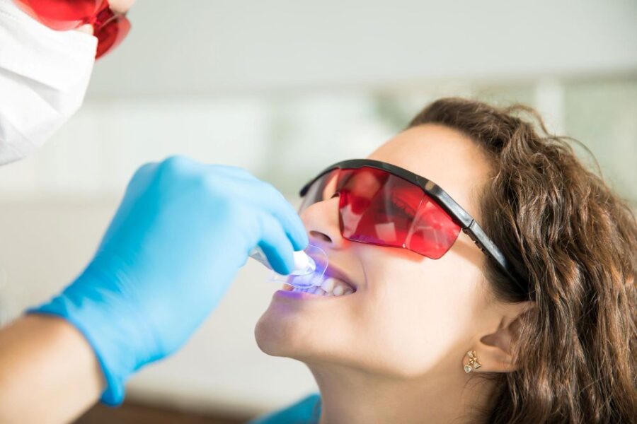 Teeth Whitening Strips vs Dentist Whitening: Safety, Sensitivity and Results